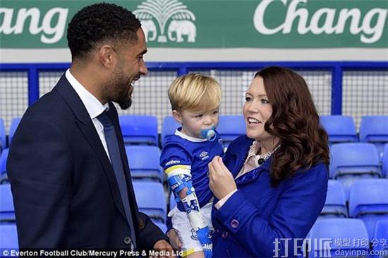 two-year-old-everton-fan-kobi-receives-3d-printed-arm-emblazoned-with-team-logo-4.jpg