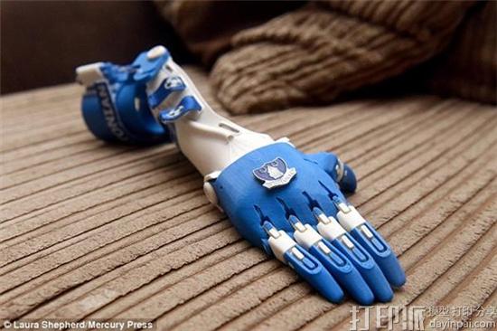 two-year-old-everton-fan-kobi-receives-3d-printed-arm-emblazoned-with-team-logo-2.jpg
