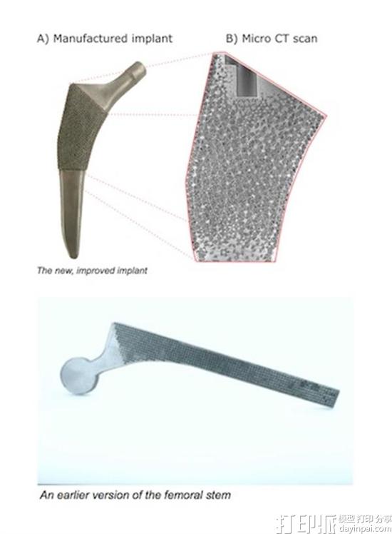 3d-printed-femoral-stem-by-mcgill-professor-extends-hip-replacement-lifespan-by-mimicking-real-bone-2.jpg