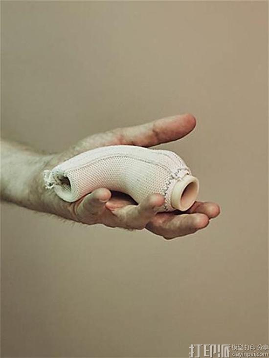 this-patient-defied-doctors-3d-printed-his-own-heart-3.jpg