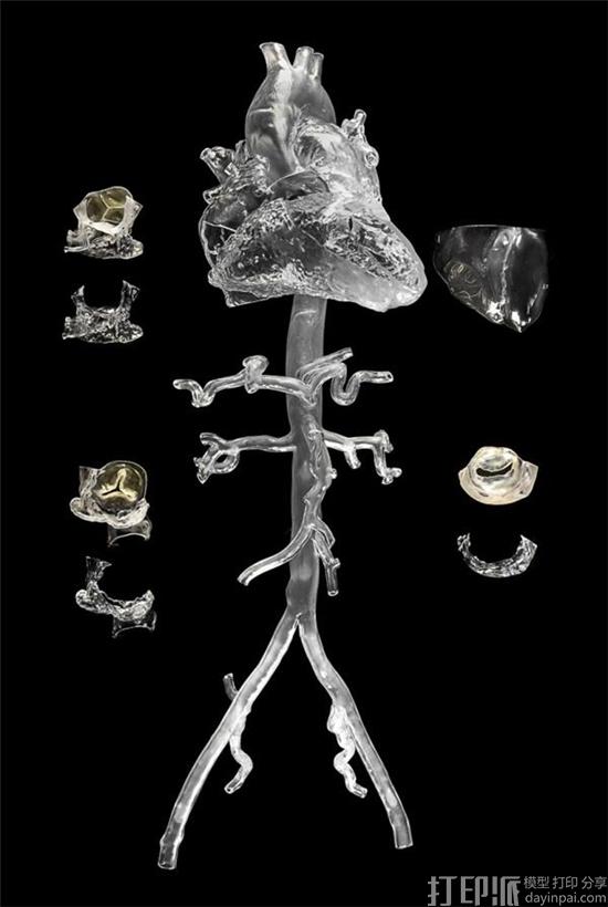 3D-printed-heart-helps-develop-lifesaving-catheter-3.jpg