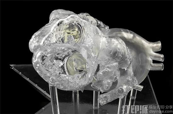 荷兰代尔夫特理工大学研究小组借3D打印心脏模型研发出救生导管.jpg