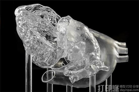 3D-printed-heart-helps-develop-lifesaving-catheter-2.jpg