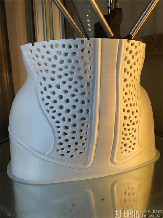 waspmedical-is-revolutionizing-scoliosis-treatment-with-3d-printing-2.jpg