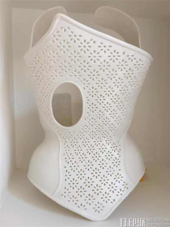 waspmedical-is-revolutionizing-scoliosis-treatment-with-3d-printing-6.png