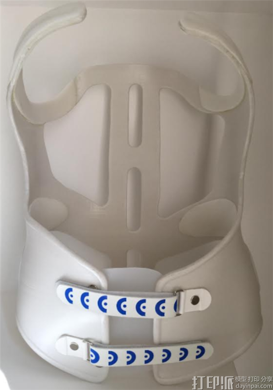 waspmedical-is-revolutionizing-scoliosis-treatment-with-3d-printing-10.png