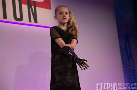 open-bionics-3d-printed-superhero-prostheses-make-children-feel-empowered-5.jpg