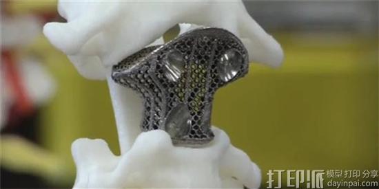 3d-printed-medical-device-market-reach-279m-2016-cagr-10-years-3.jpg