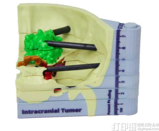 new-3dyourscan-service-3d-prints-patient-specific-surgical-models-in-less-than-24-hrs-3.jpg