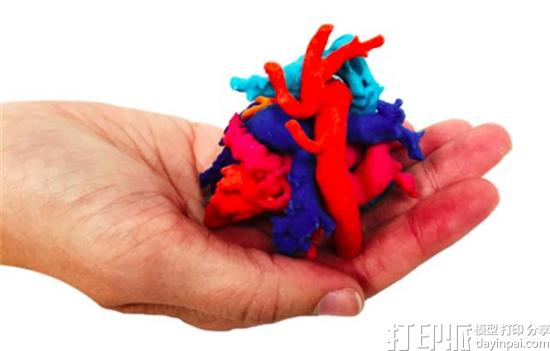 new-3dyourscan-service-3d-prints-patient-specific-surgical-models-in-less-than-24-hrs-5.jpg