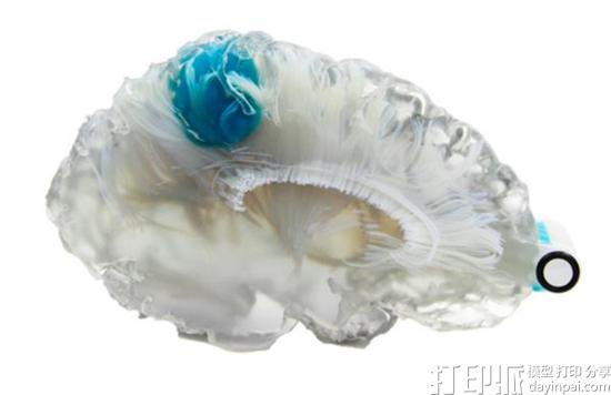 new-3dyourscan-service-3d-prints-patient-specific-surgical-models-in-less-than-24-hrs-4.jpg