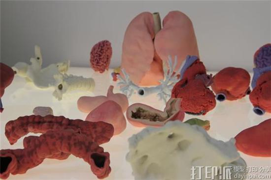 new-3dyourscan-service-3d-prints-patient-specific-surgical-models-in-less-than-24-hrs-6.jpg