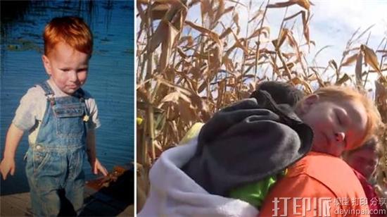 3D-printed-skull-gives-young-boy-second-chance-life-2.jpg