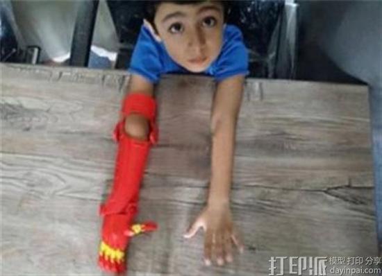 bioniks-wants-to-give-pakistani-children-3d-printed-superhero-prosthetic-hands-1.jpg