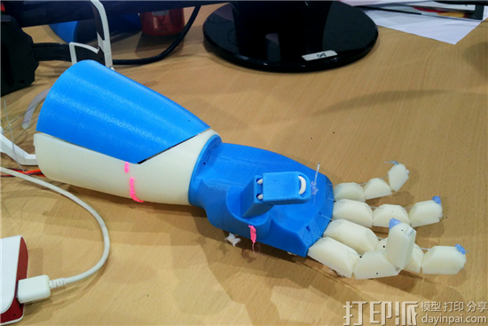 Bionic-forearm.png