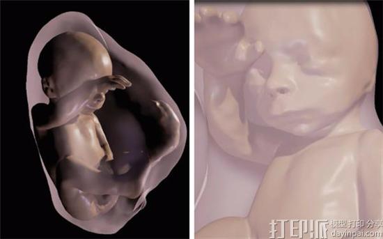 新的3D扫描技术+VR头显能让父母看到全面的胎儿状态.jpg