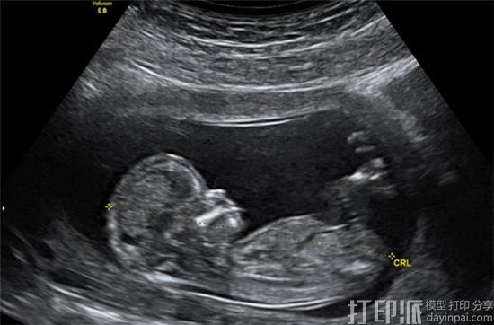new-scanning-method-allows-parents-see-unborn-children-3d-models-vr-4.jpg