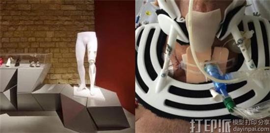 german-3d-printed-prosthetics-manufacturer-mecuris-secures-major-investment-2.jpg