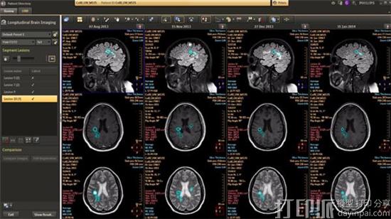 1480500265461319.jpg philips-updates-3d-printing-3d-rendering-solutions-with-intellispace-portal-9-1.jpg