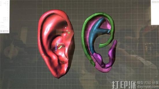 nine-year-old-girl-to-receive-new-ear-thanks-to-3d-scanning-and-printing-tech-2.jpg