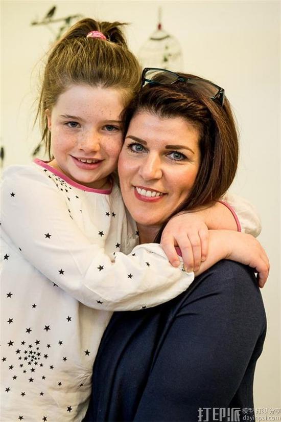 nine-year-old-girl-to-receive-new-ear-thanks-to-3d-scanning-and-printing-tech-4.jpg
