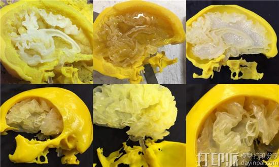 神经科学专家Saleem Abdulrauf谈对3D打印大脑模型的看法.jpg