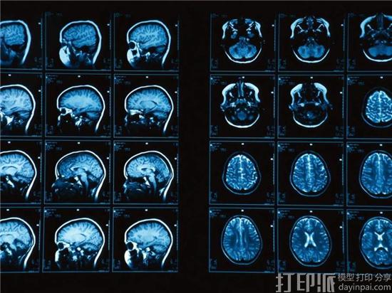 Brain-MRI-Scan-Photograph-by-Ken-GlaserCorbis-906x679.jpg