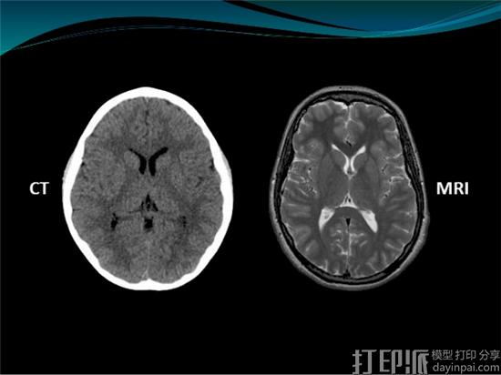 ct-scan-vs-mri-scan-4-638.jpg