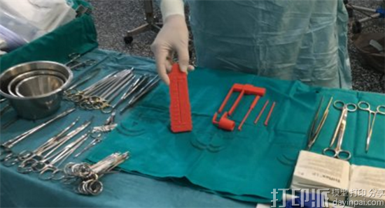 西班牙外科医生为患者使用特定的3D打印手术器械