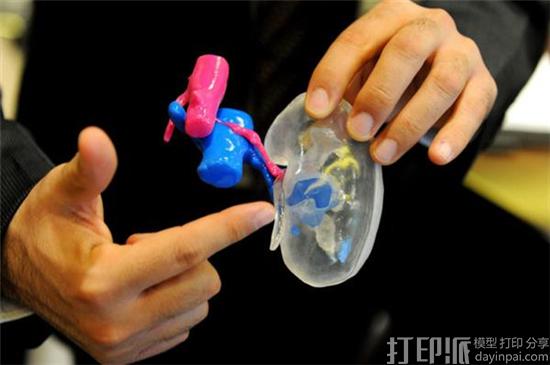 阿联酋医生在3D打印模型的帮助下仅用28分钟帮病患去除肾脏肿瘤