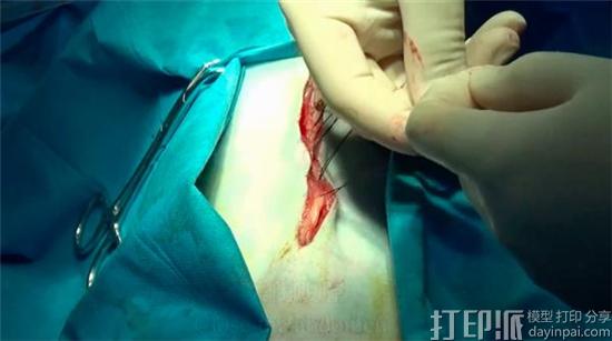 中国科学家制作出生物3D打印血管并成功移植到猴子体内