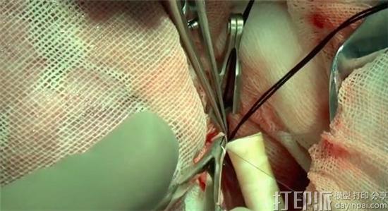 中国科学家制作出生物3D打印血管并成功移植到猴子体内