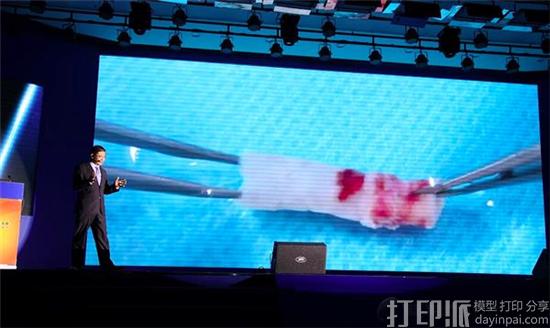 中国科学家制作出生物3D打印血管并成功移植到猴子体内
