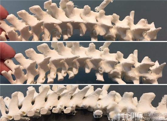 巴西解剖学专家兼医生呼吁3D打印技术在医疗系统普及