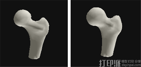 研究人员借3D扫描和3D打印揭示关节疼痛的“病根”