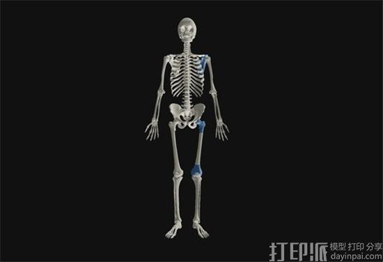 研究人员借3D扫描和3D打印揭示关节疼痛的“病根”