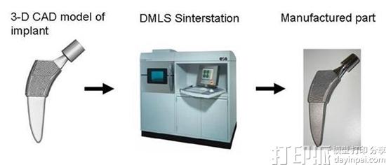 爱尔兰科学家研发出更具耐久性的3D打印骨骼植入物