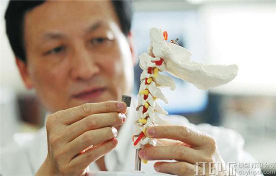 金属3D打印技术对于脊柱手术来说有什么帮助？