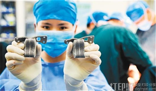 3D打印脊椎植入物是怎么打印出来的？用的什么材料？
