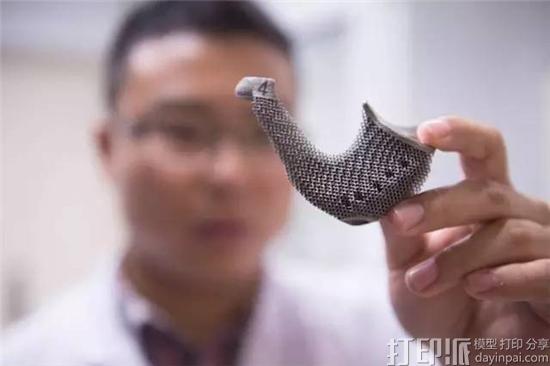 3D打印在医疗行业中具备哪些优点？