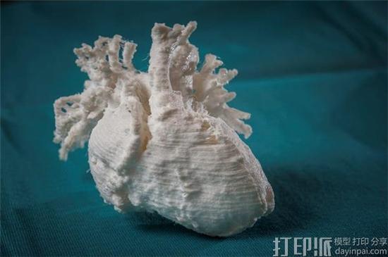 世界首个被应用到手术中的3D打印心脏模型将永久阿存于荷兰Boerhaave博物馆