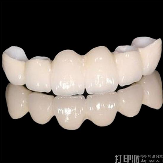 3D打印陶瓷通常用来做什么？