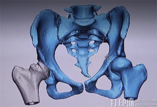 渥太华医院成加拿大首家建立综合3D打印方案的医院