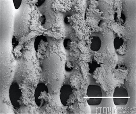 得益于3D打印支架 休斯敦莱斯大学科学家在骨癌研究上取得新进展