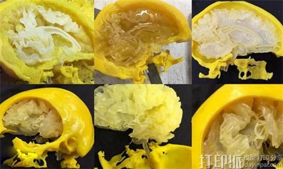 3D打印大脑模型有什么用处？