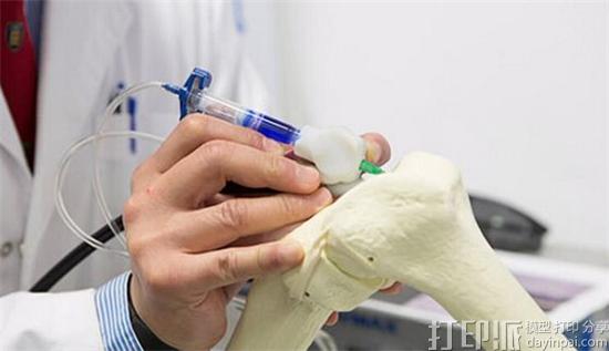 3D打印在骨科医疗上能起到哪些作用？