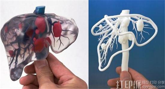 3D打印医疗器械有哪些细分市场？