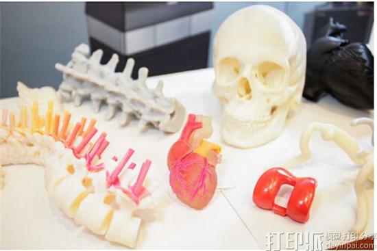 为什么医疗行业会如此积极热衷的应用3D打印技术？