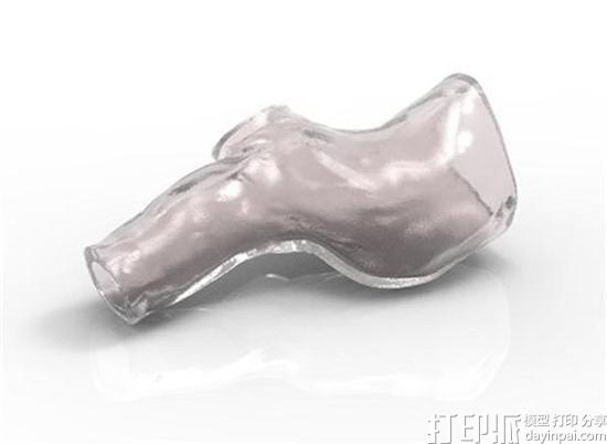 法国医生成功完成全球首例3D打印模具制作的支气管植入手术