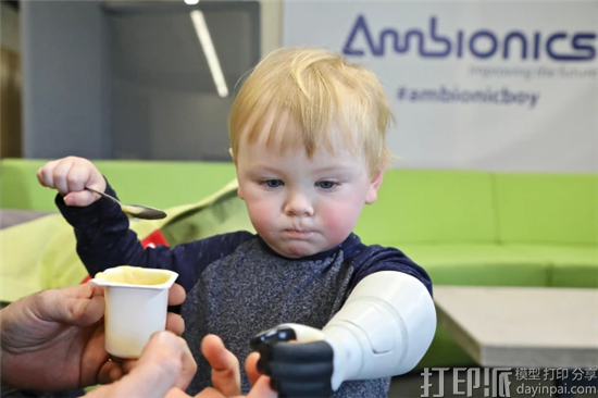 男童因病截肢 父亲辞职为其造3D打印假肢并成立假肢公司 男童因病截肢 父亲辞职为其造3D打印假肢并成立假肢公司